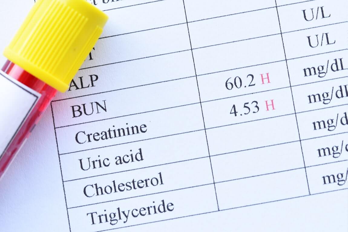 blood test results with blood sample tube