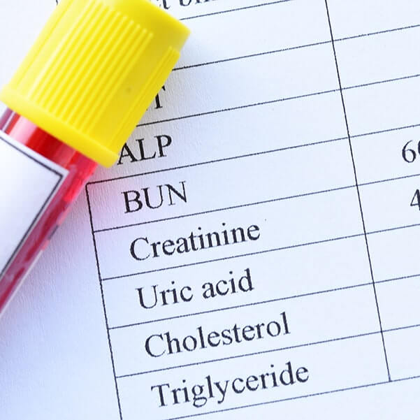 blood test results with blood sample tube